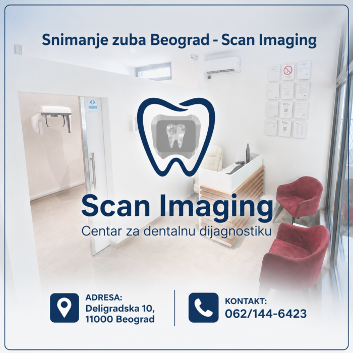 Snimanje zuba Beograd – Scan Imaging
